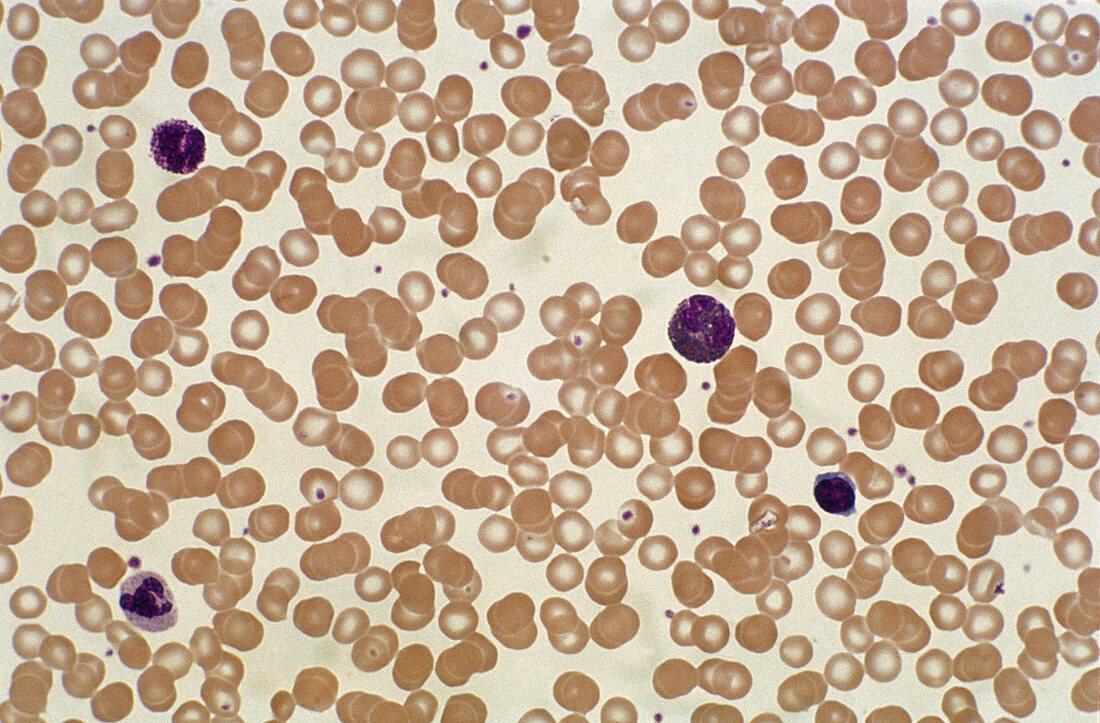 Normal Blood Smear (LM)