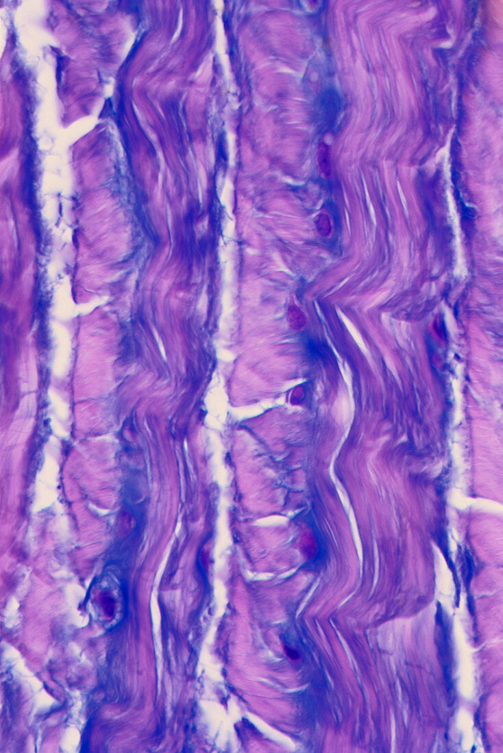 Fibrous Connective Tissue (LM)
