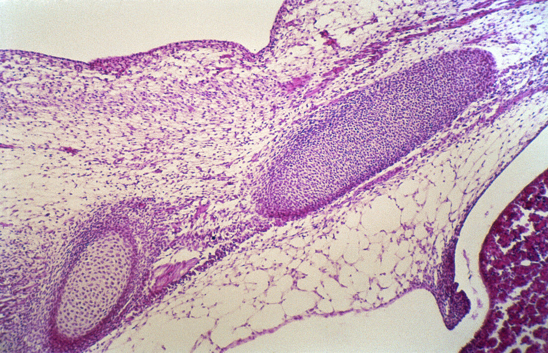 Mesenchymal Connective Tissue (LM)