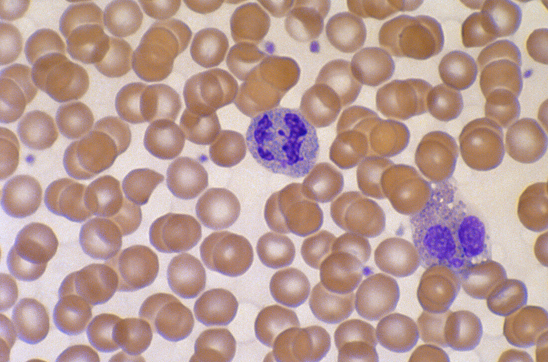 Normal Blood Smear (LM)