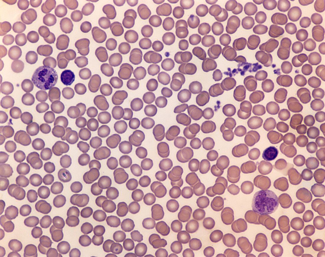 Normal Blood Smear (LM)