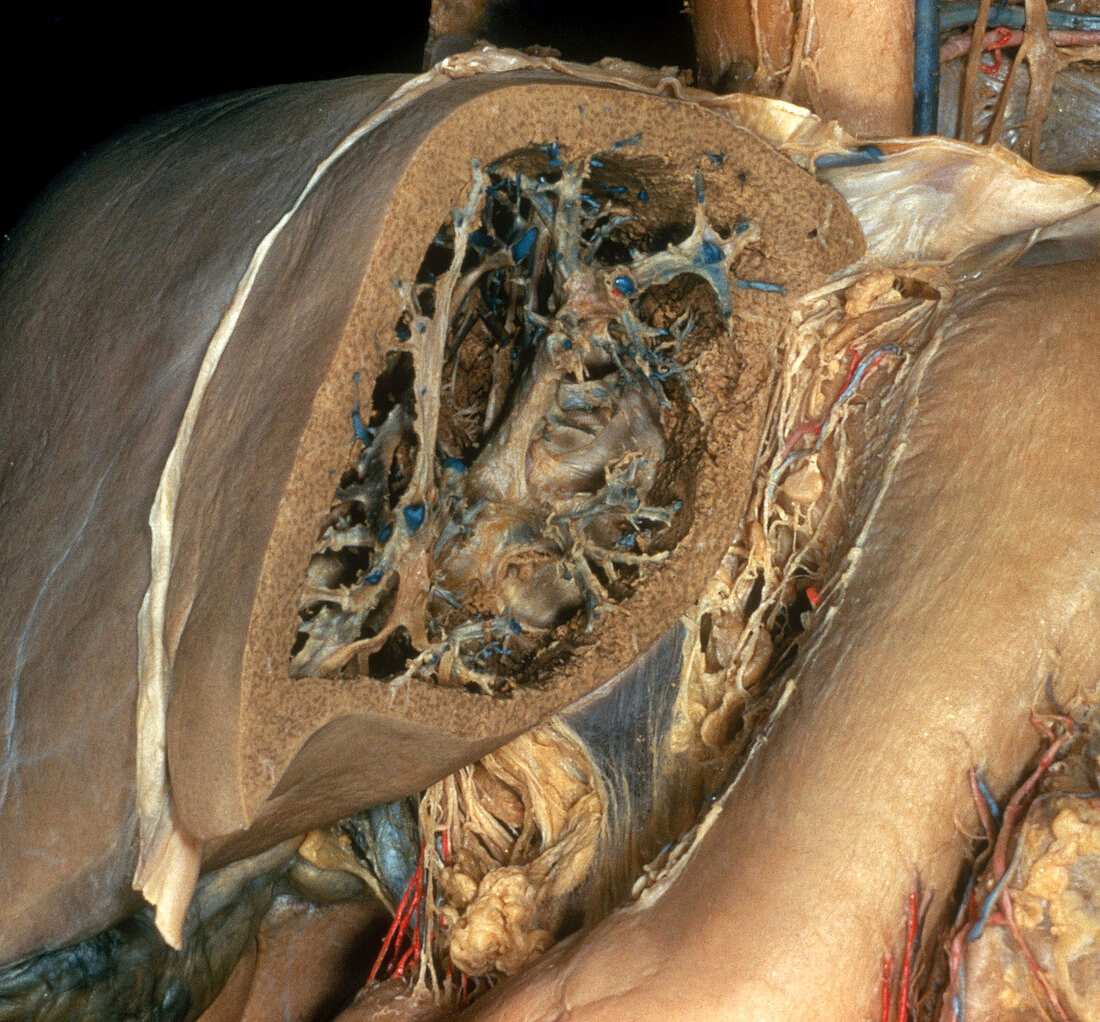 Dissected Liver