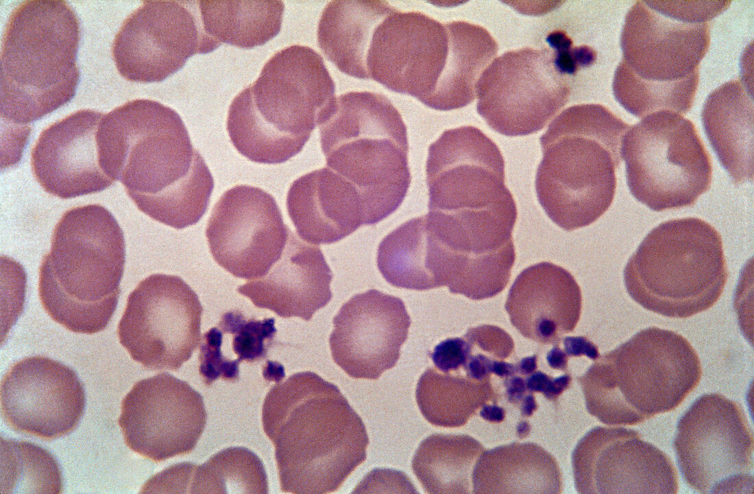 Red Blood Cells and Platelets (LM)