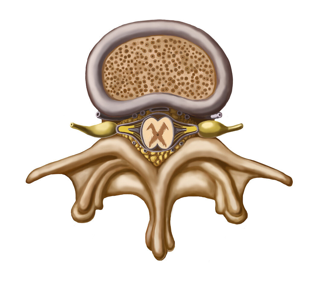 Spinal Disc