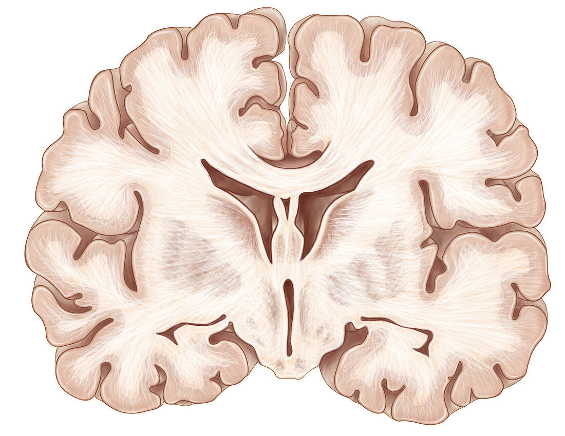 Brain,Coronal Section