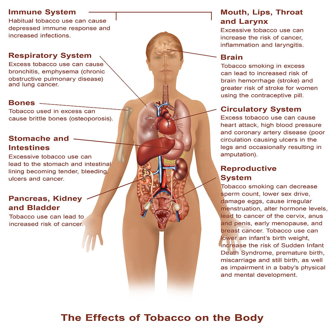 Effects of Tobacco Use