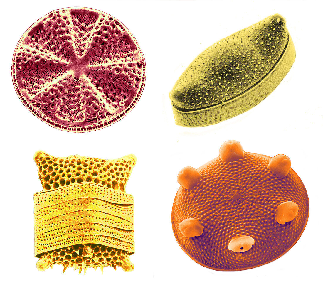 Diatoms (SEM)