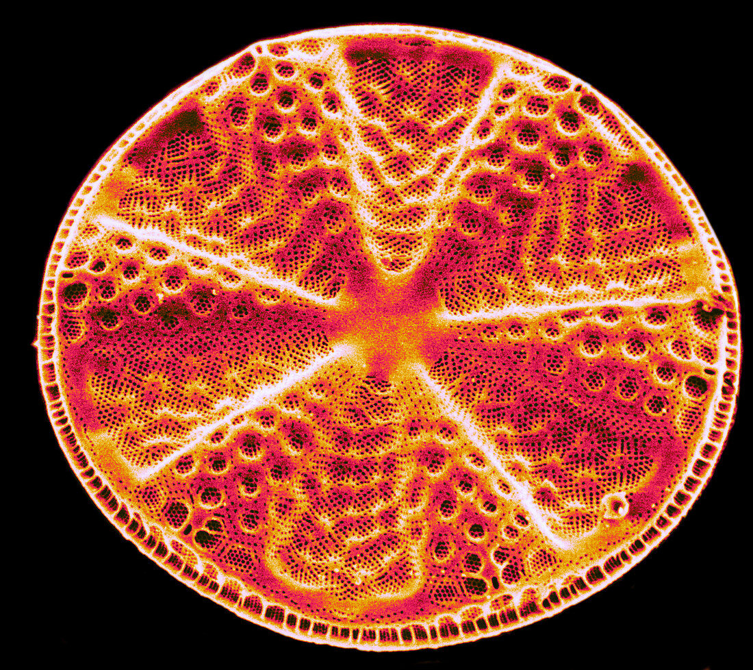 Diatom - Actinoptychus
