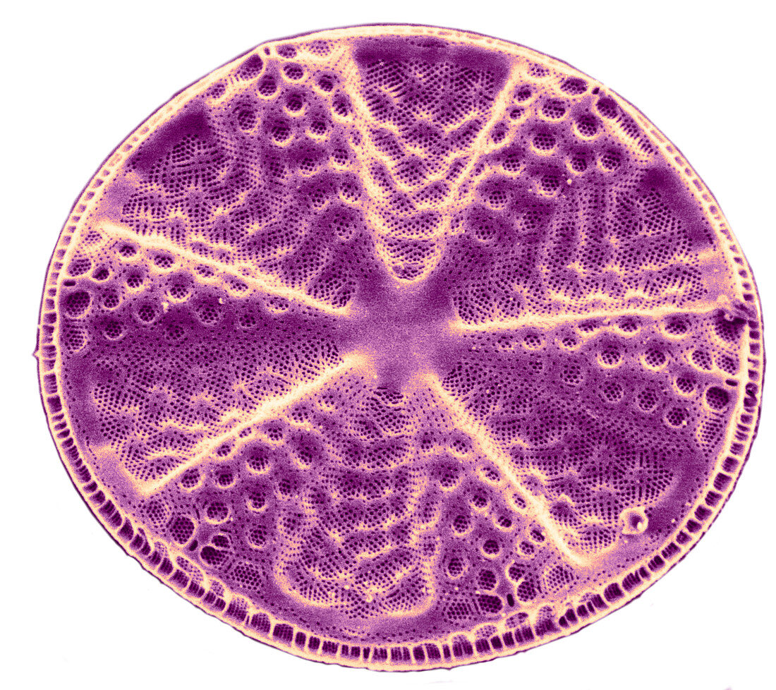 Diatom - Actinoptychus