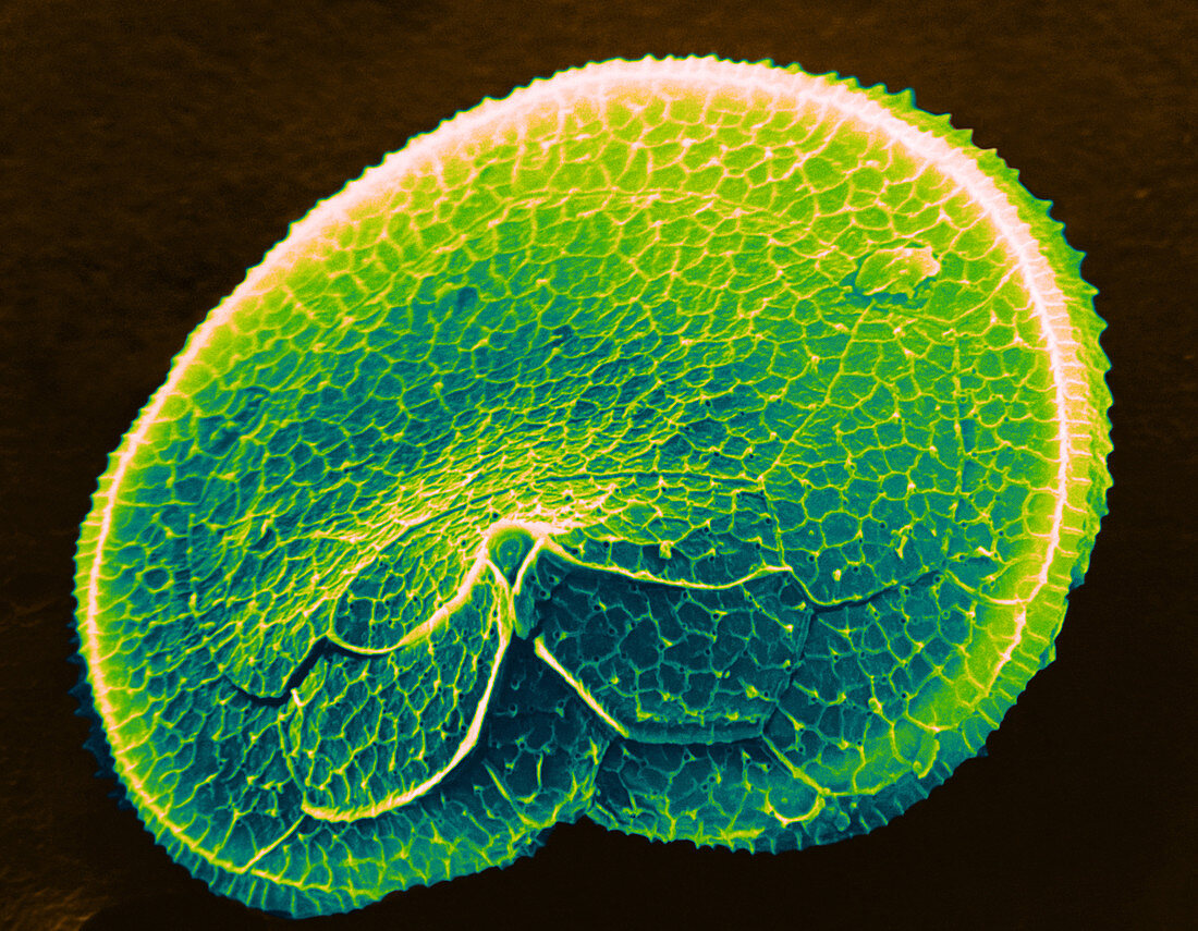 Protoperidinium Dinoflagellate
