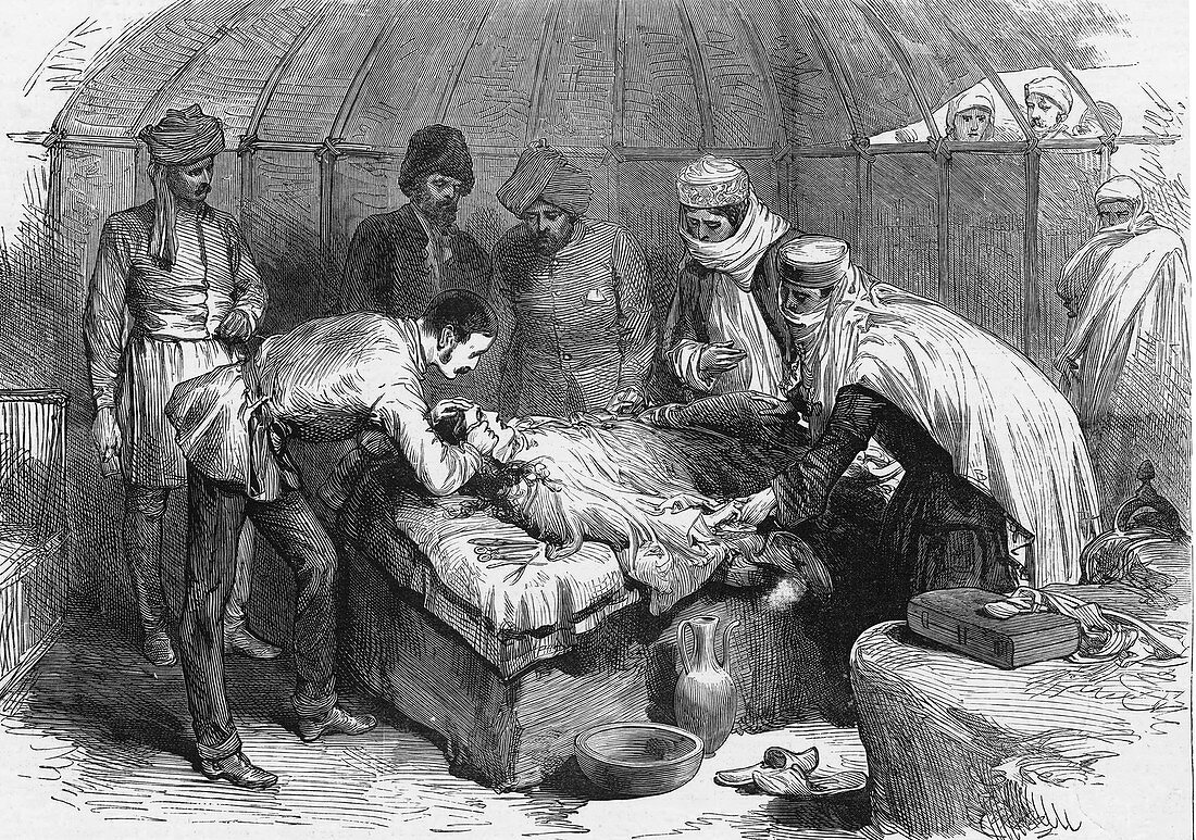 Burn Surgery,1885