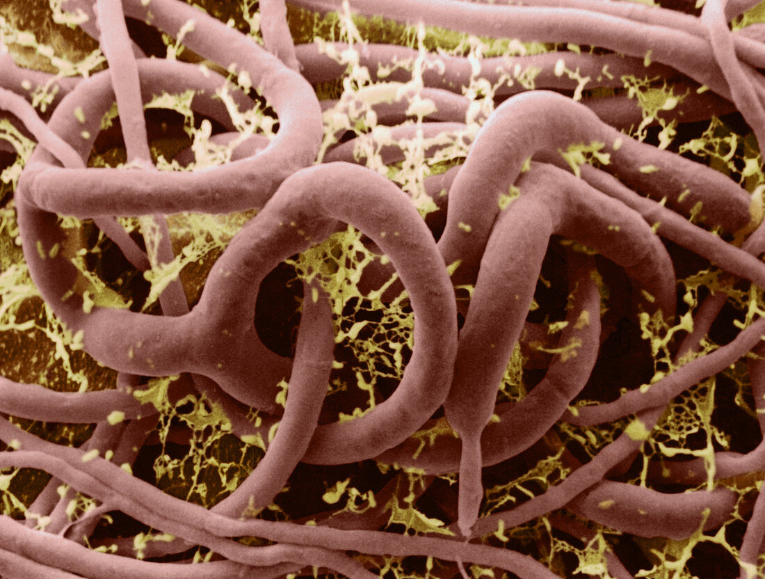 Arthrobotrys oligospora,SEM