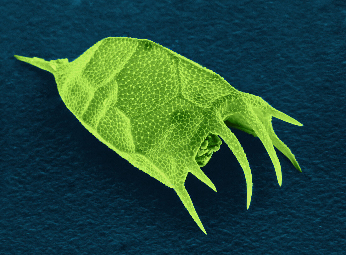 Keratella sp. Rotifer,SEM