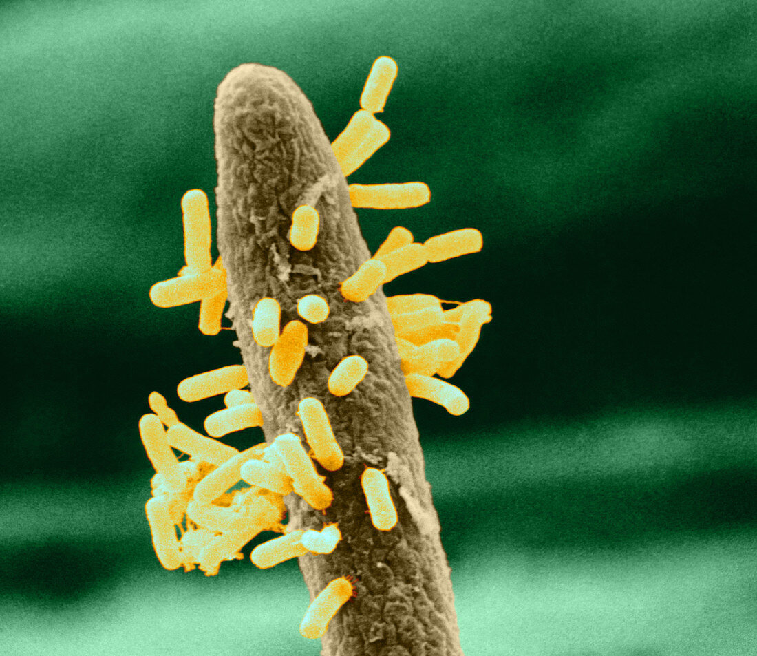 Bacteria on Root Hair