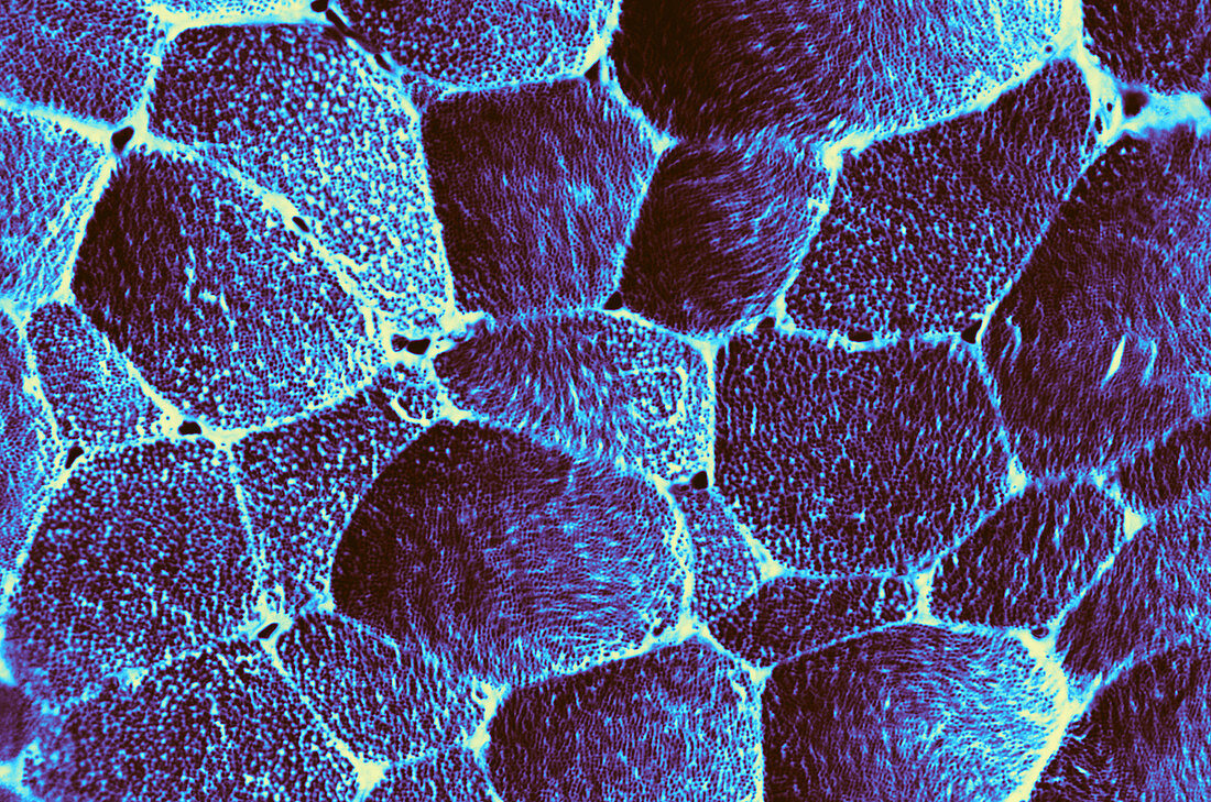 Striated Muscle Fibers,LM