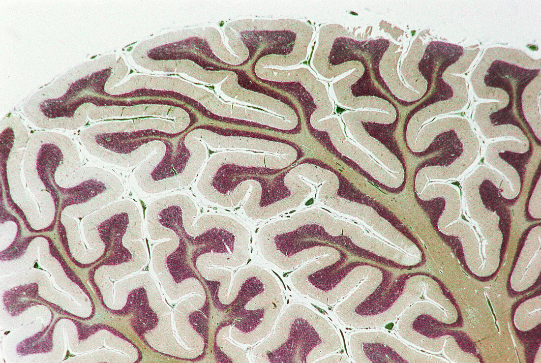 Cerebellum,LM