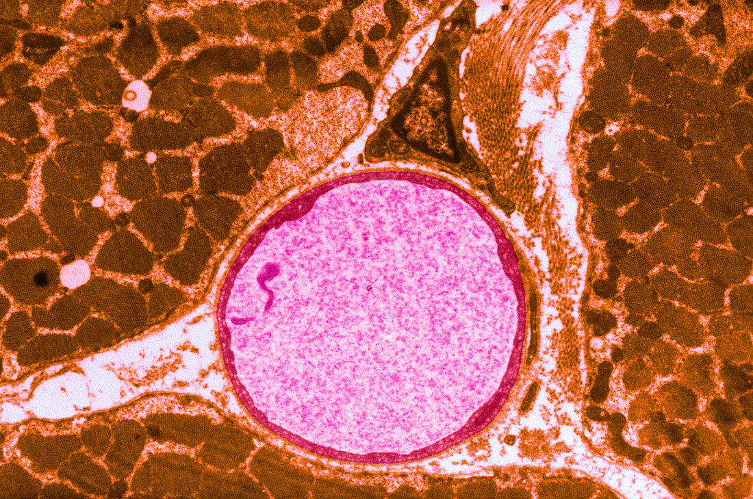 Capillary with Endothelial Cytoplasm,TEM