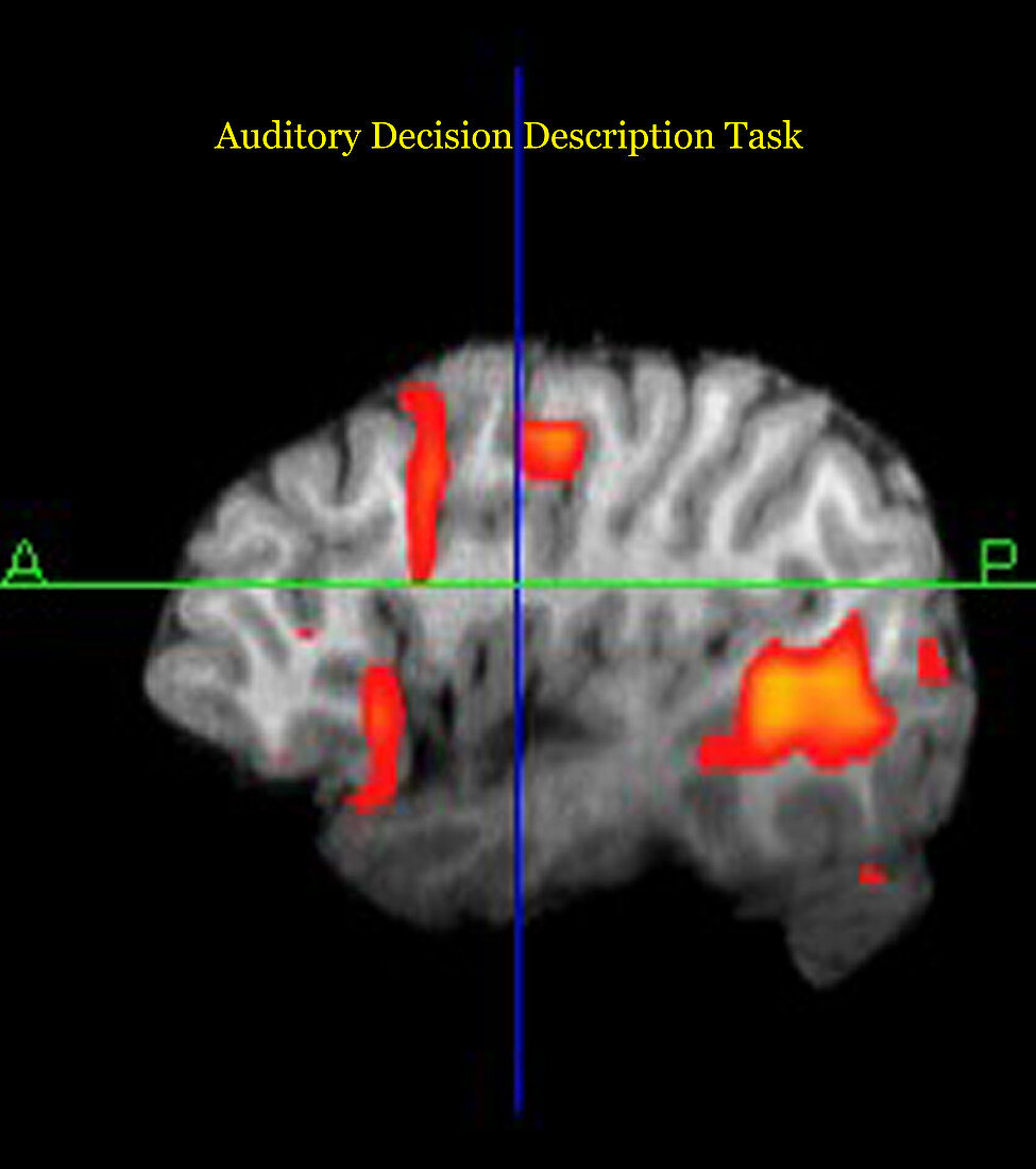 Brain Activity during Language Task