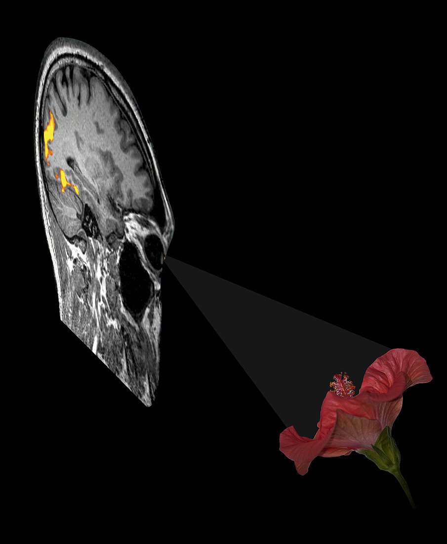BOLD fMRI Response to Visual Stimulus
