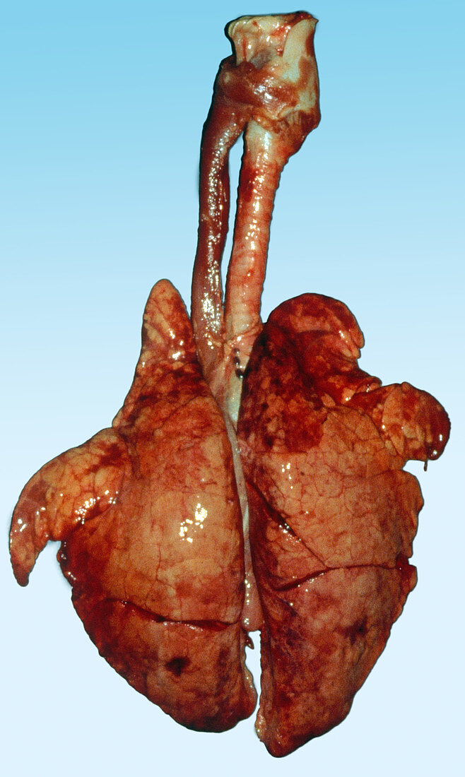 Lungs,Gross Specimen