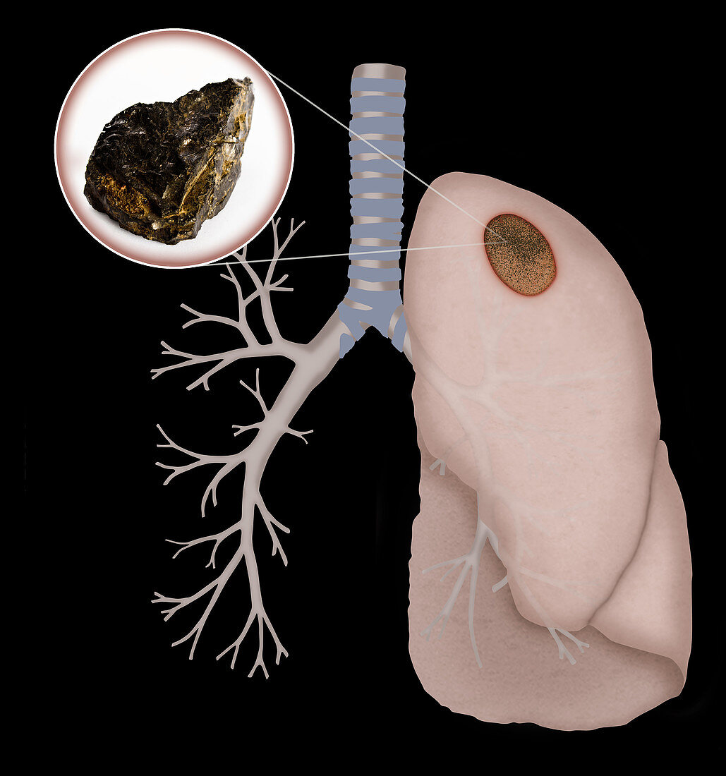 Black Lung,Illustration