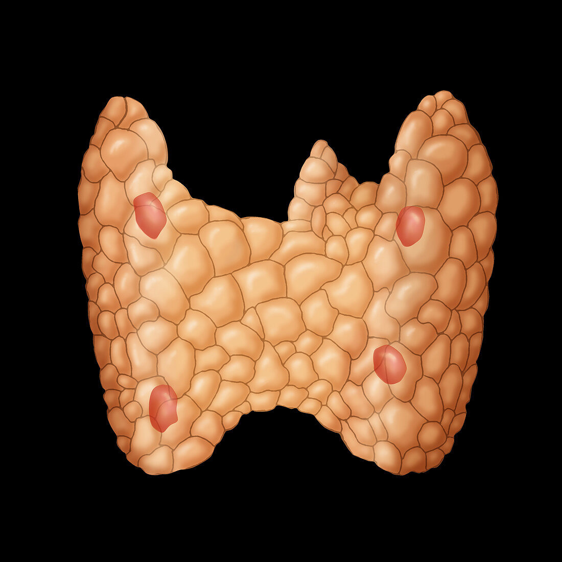 Parathyroid,Illustration