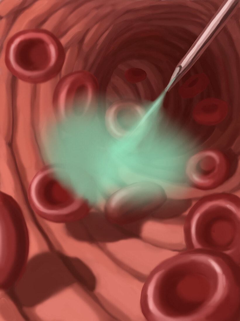 Vaccine,Illustration