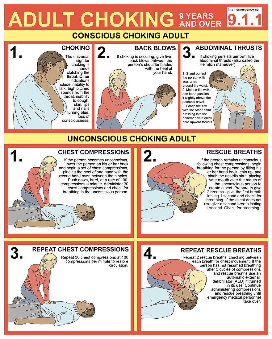 Choking First Aid Chart,Illustration