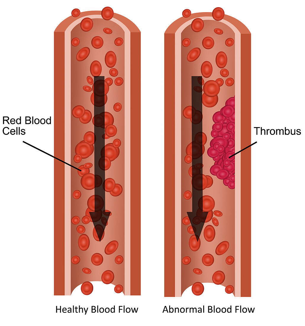 Blood Flow,Illustration