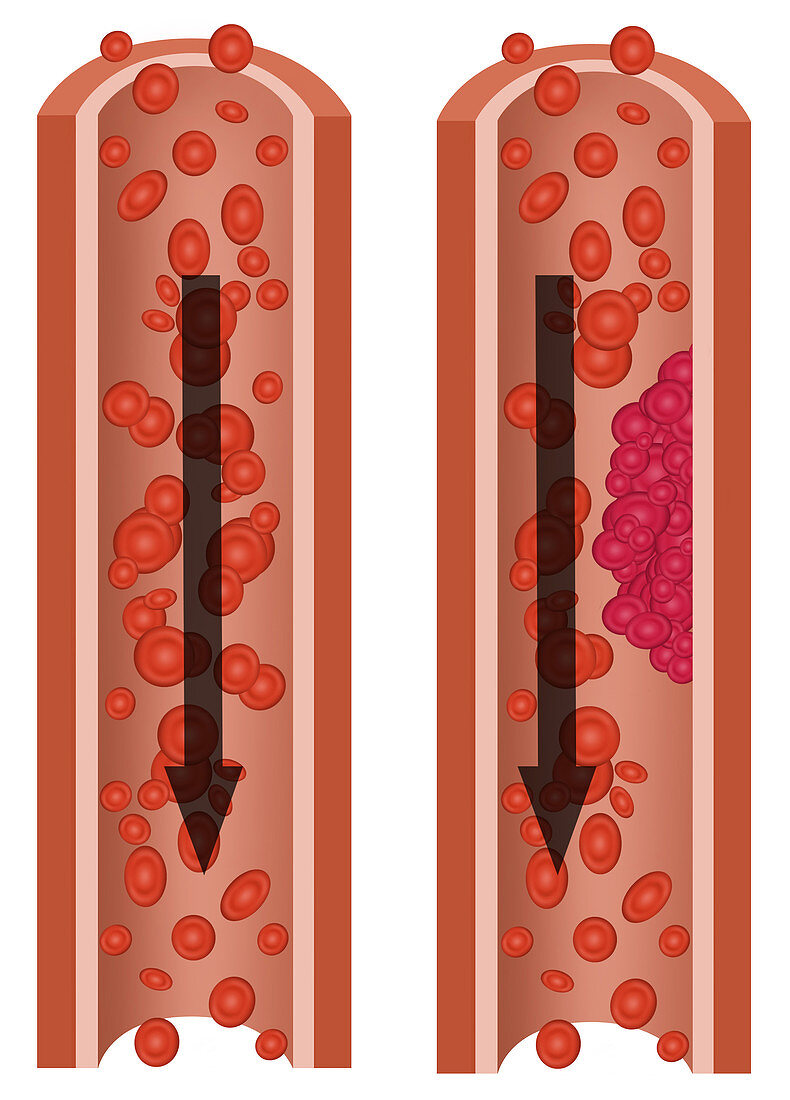 Blood Flow,Illustration