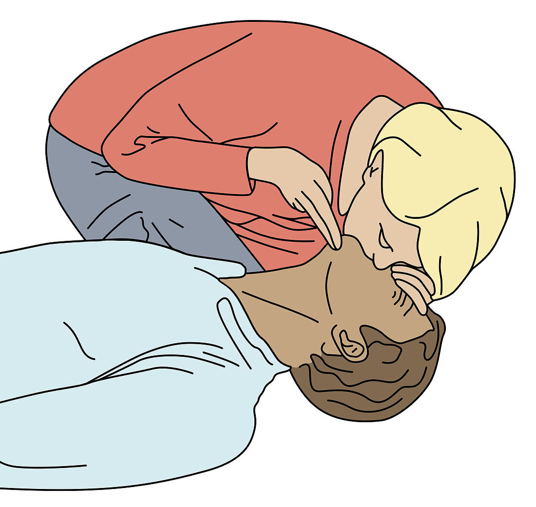 Choking First Aid,Illustration