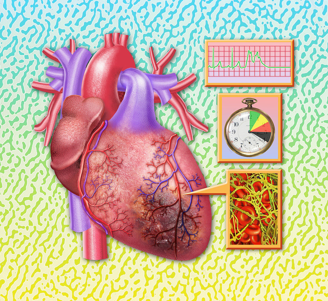 Heart Attack,Illustration