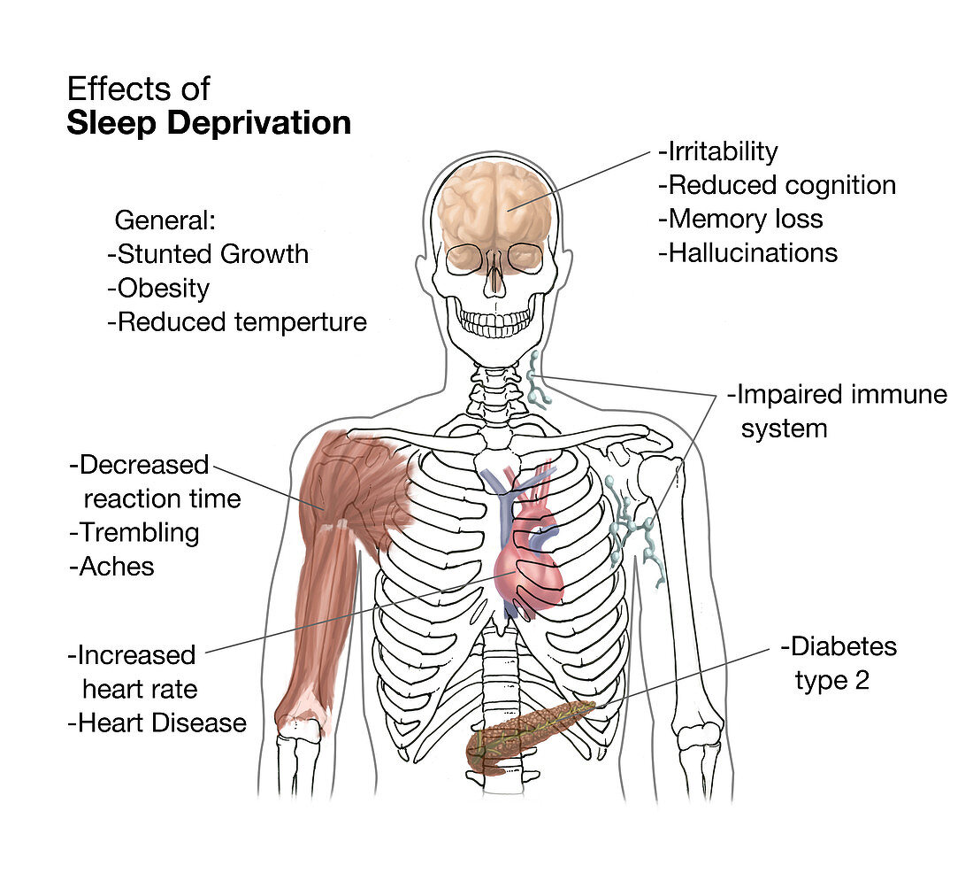 Sleep Deprivation Effects,Illustration