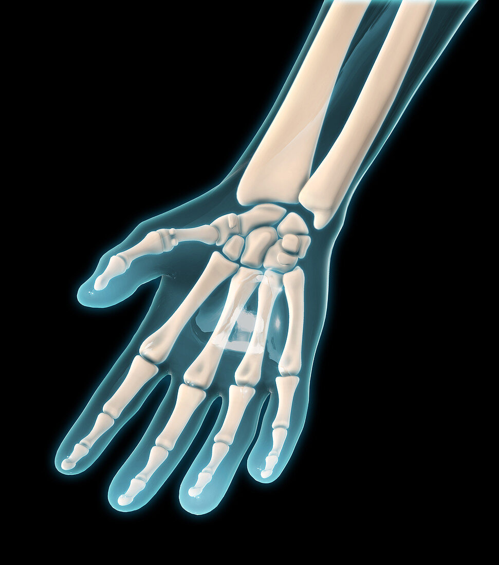 Bones of the Hand,Illustration