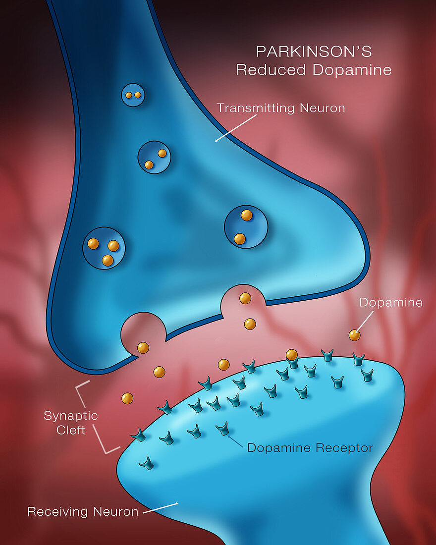 Dopamine in Parkinson's,Illustration