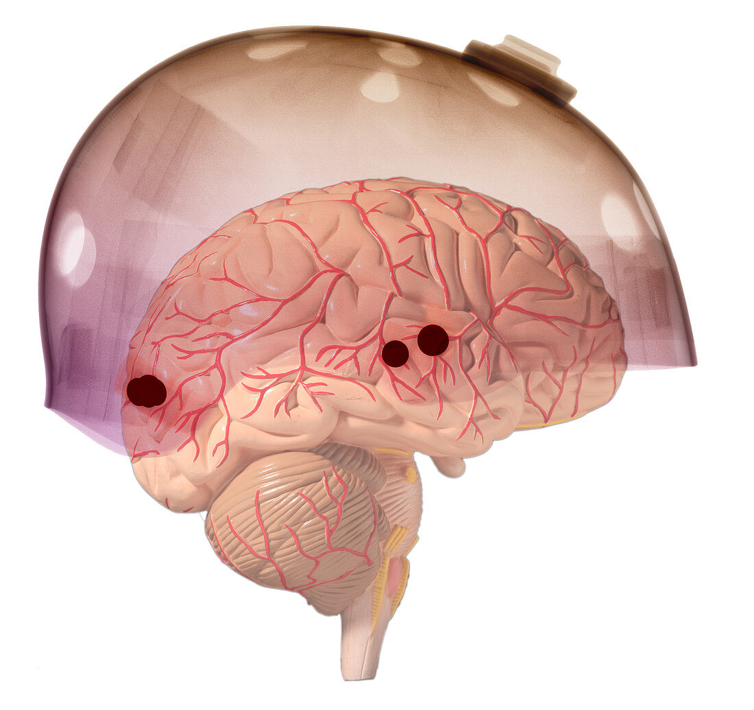 Brain in Skateboard Helmet
