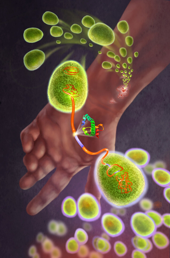 Staph infection,illustration