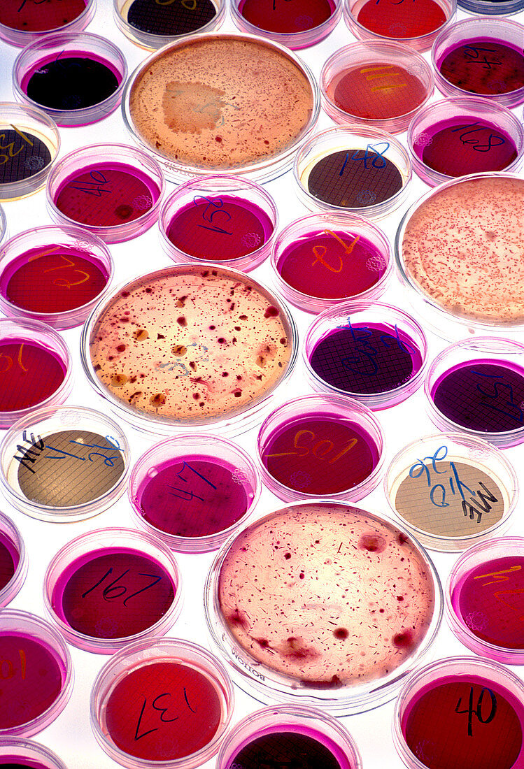 Coliform Bacteria in Petri Dishes