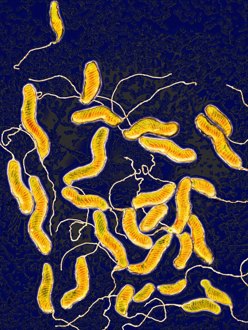 Helicobacter pylori bacteria,LM