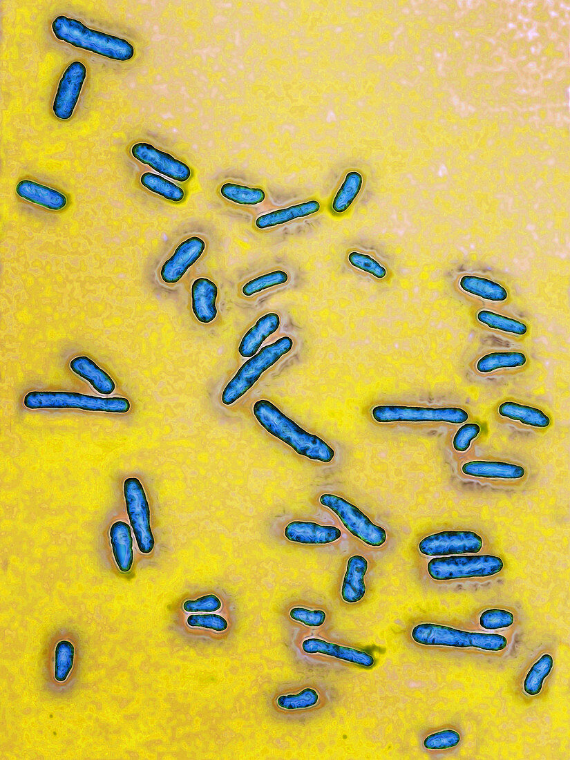 Shigella bacteria,LM