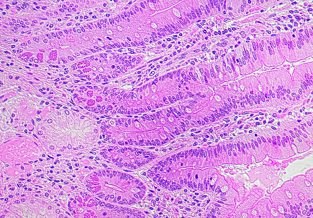 Duodenum wall,TS for Paneth cells