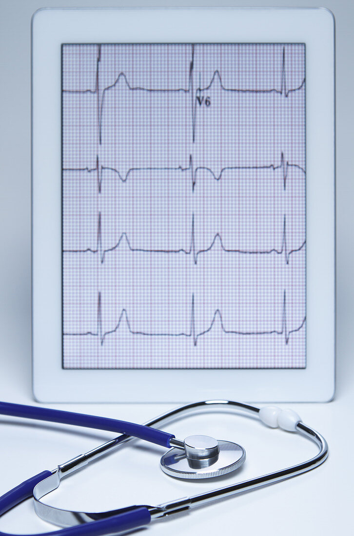 Electrocardiogram on an iPad