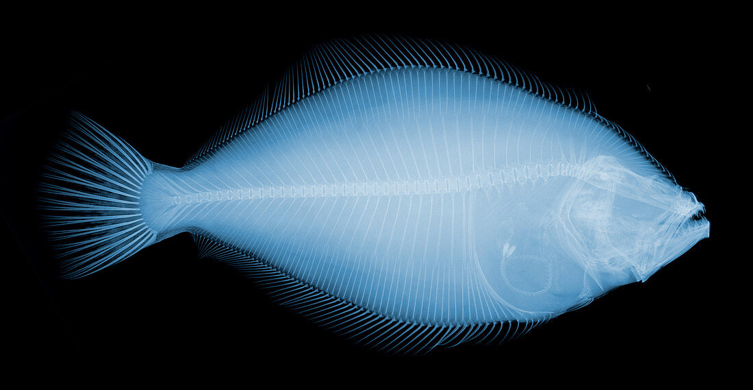 Flounder Fish,X-ray