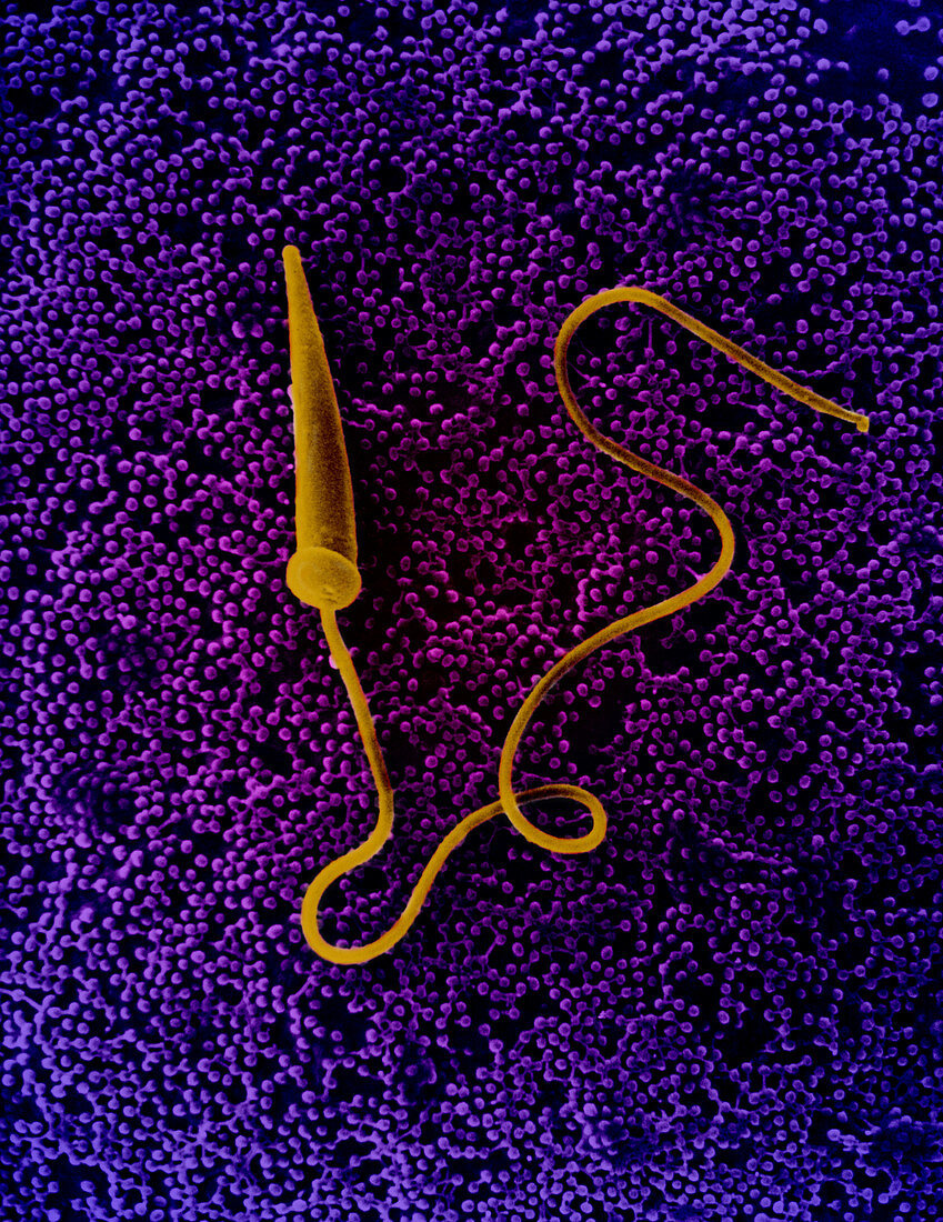 Starfish Sperm,SEM