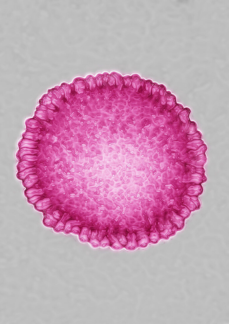 Flu virus A (H1N1)