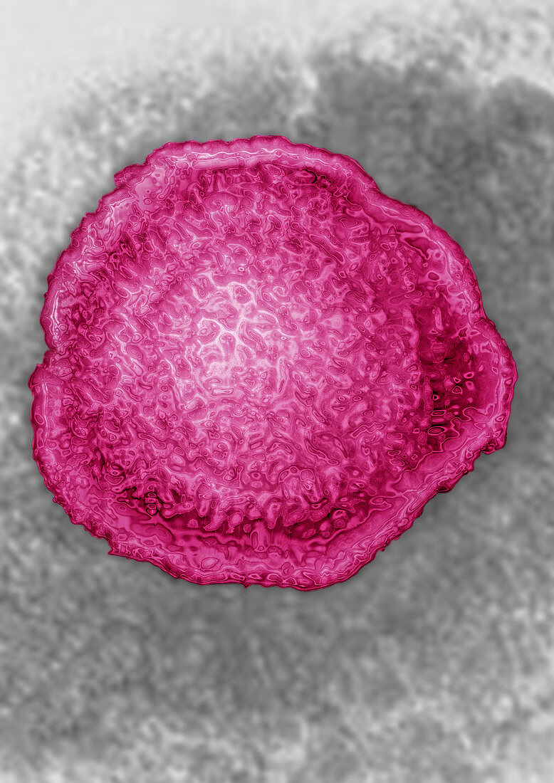Varicella Zona Virus (VZV - HSV3)
