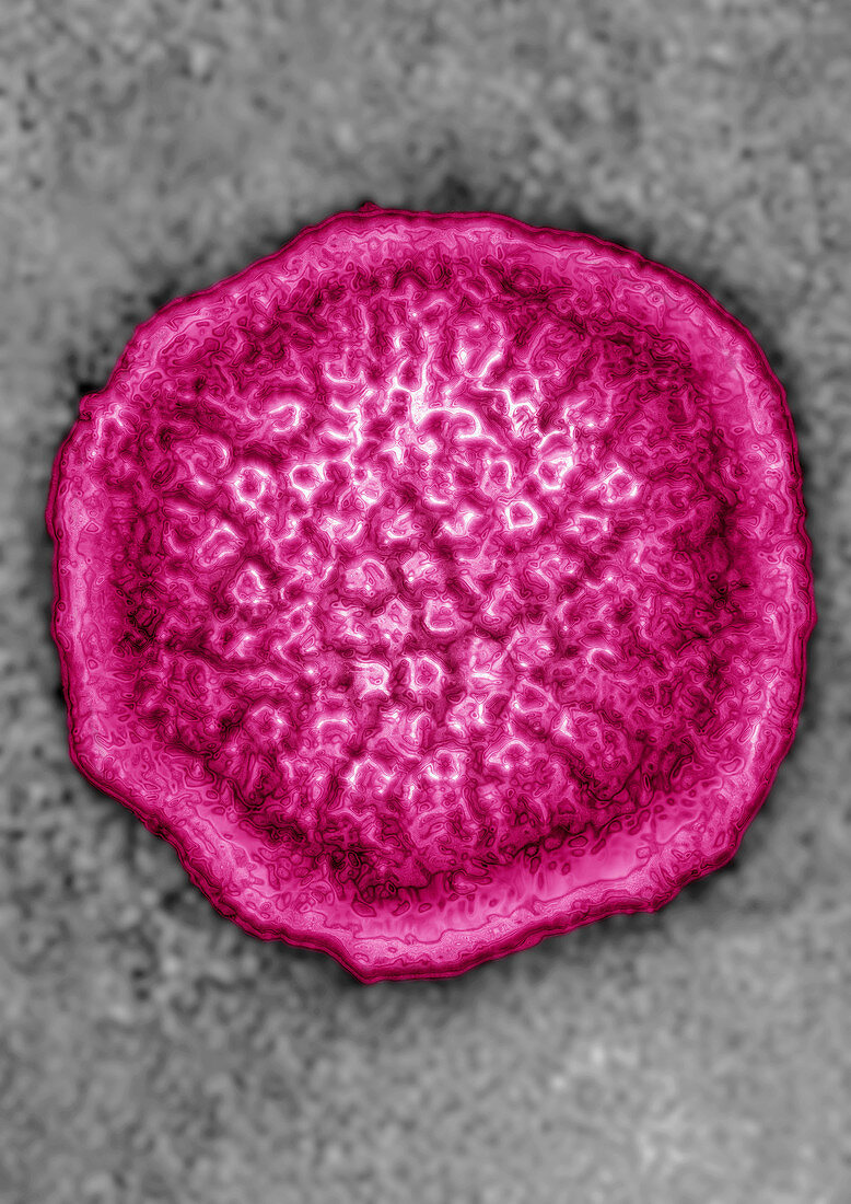 Epstein-Barr Virus (HSV4)