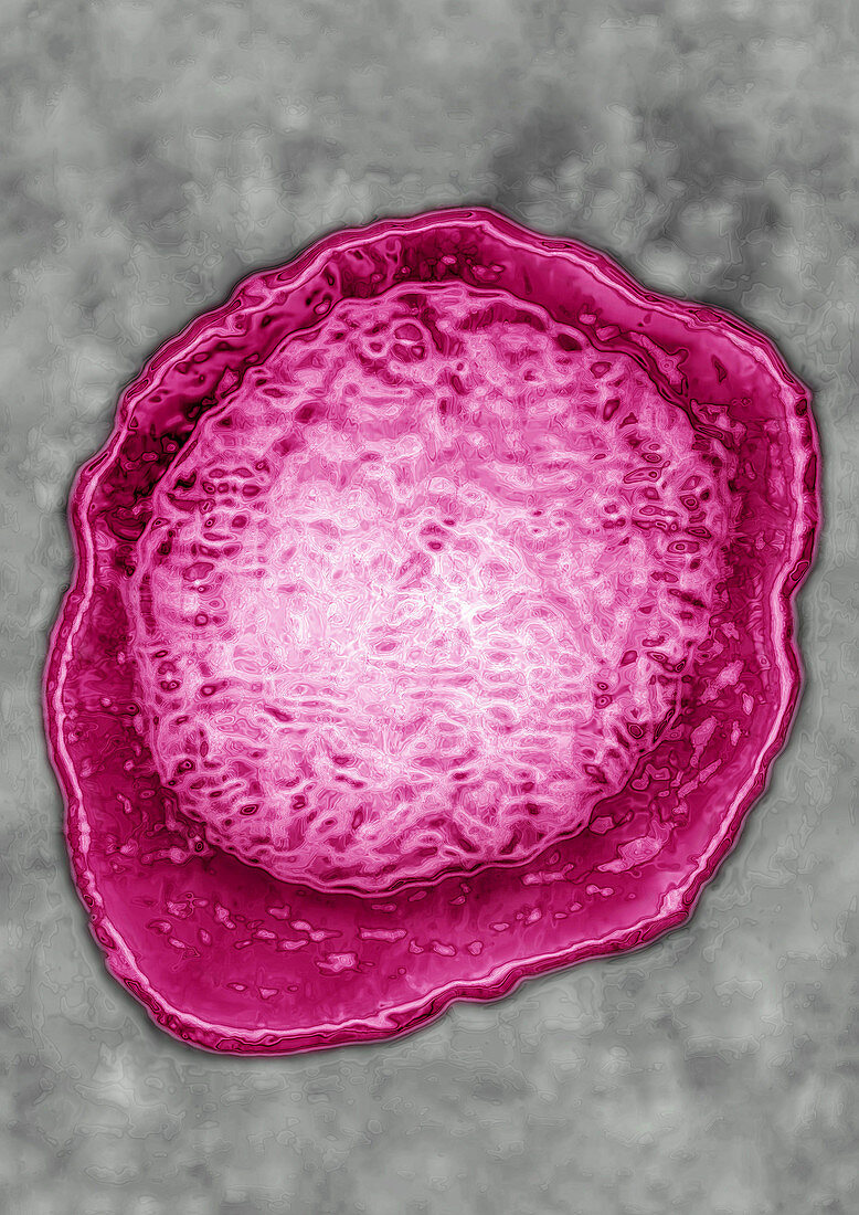 Herpes Simplex Virus (HSV 6 & 7)