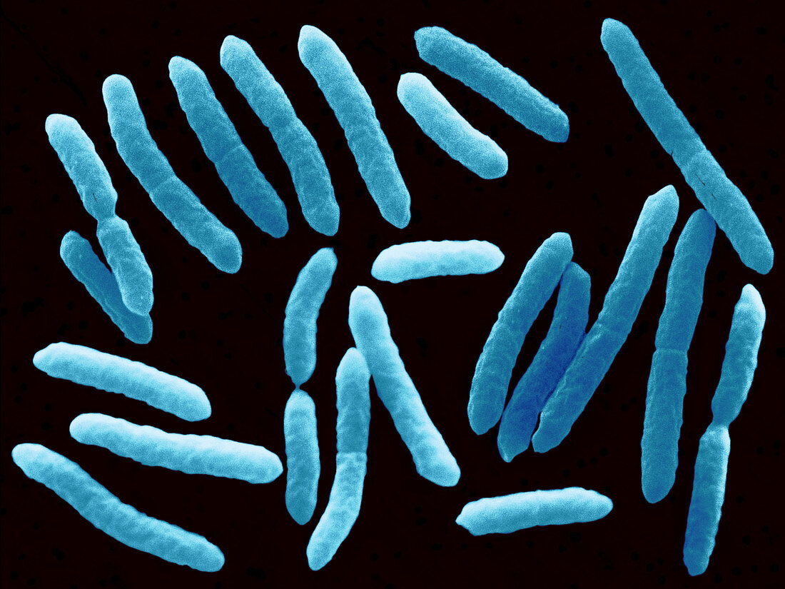 Toxigenic Escherichia coli O145