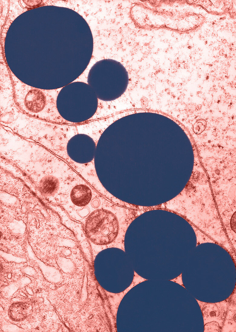 Lipid in Sertoli Cell,TEM